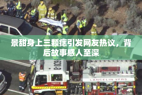 景甜身上三颗痣引发网友热议，背后故事感人至深