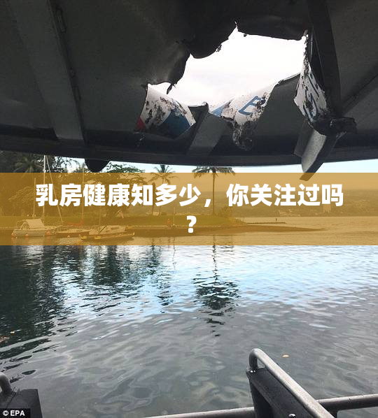 乳房健康知多少，你关注过吗？