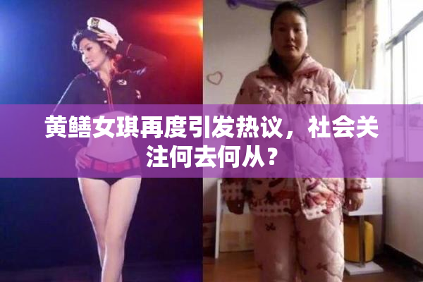 黄鳝女琪再度引发热议，社会关注何去何从？