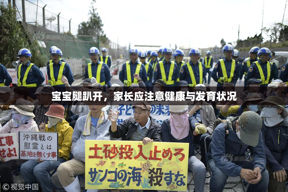 宝宝腿趴开，家长应注意健康与发育状况