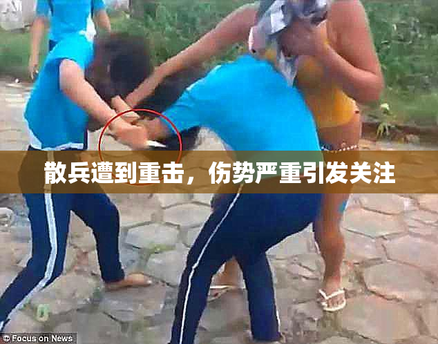 散兵遭到重击，伤势严重引发关注