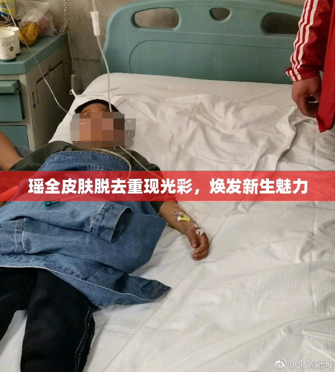 瑶全皮肤脱去重现光彩，焕发新生魅力