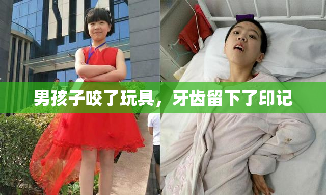 男孩子咬了玩具，牙齿留下了印记